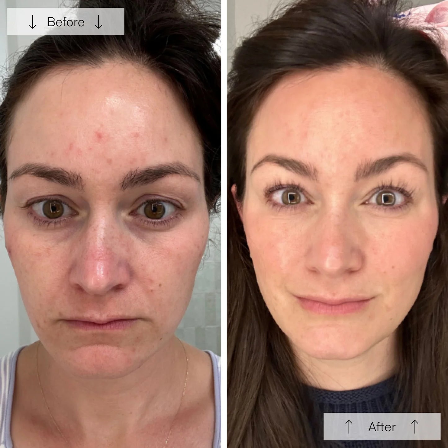 GlowVibe™ - LED Face Mask